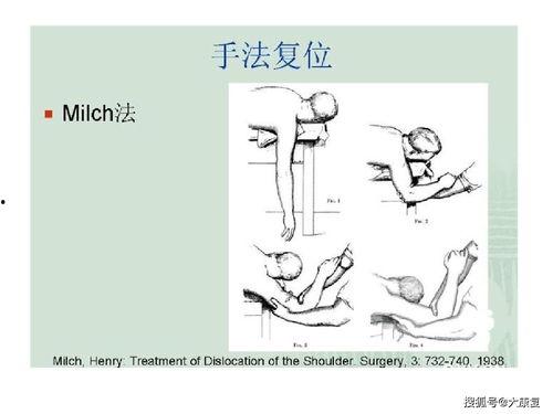 成人肩膀脱臼复位手法视频,专业手法视频解析