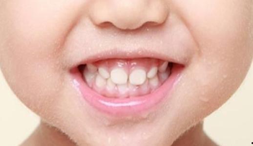 成人可以包牙吗视频,包牙技术革新解析